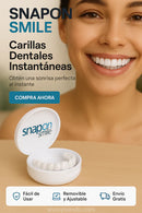Belleza Carillas Dentales Removibles – Sonríe con Confianza al Instante de Tendeli- Ecuador en
