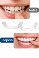 Belleza Carillas Dentales Temporales Ecuador - Snap On Smile Dientes Perfectos Sin Dentista de Tendeli- Ecuador en